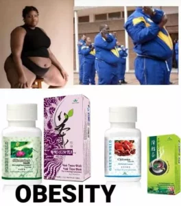 Obesity Reversal